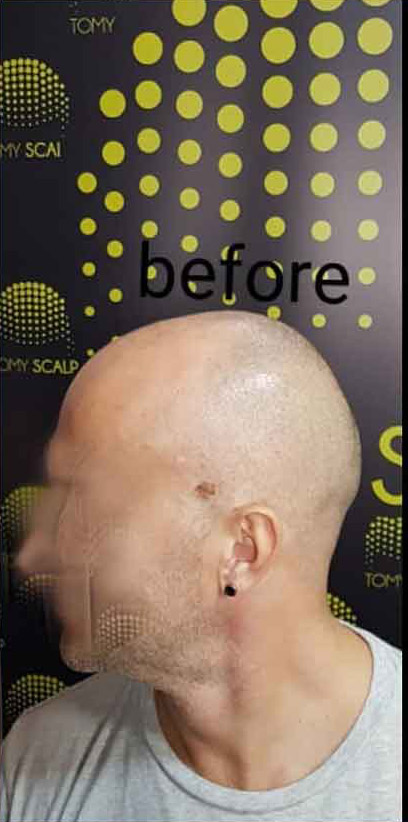 Mikropigmentacija Vlasista1 2 1