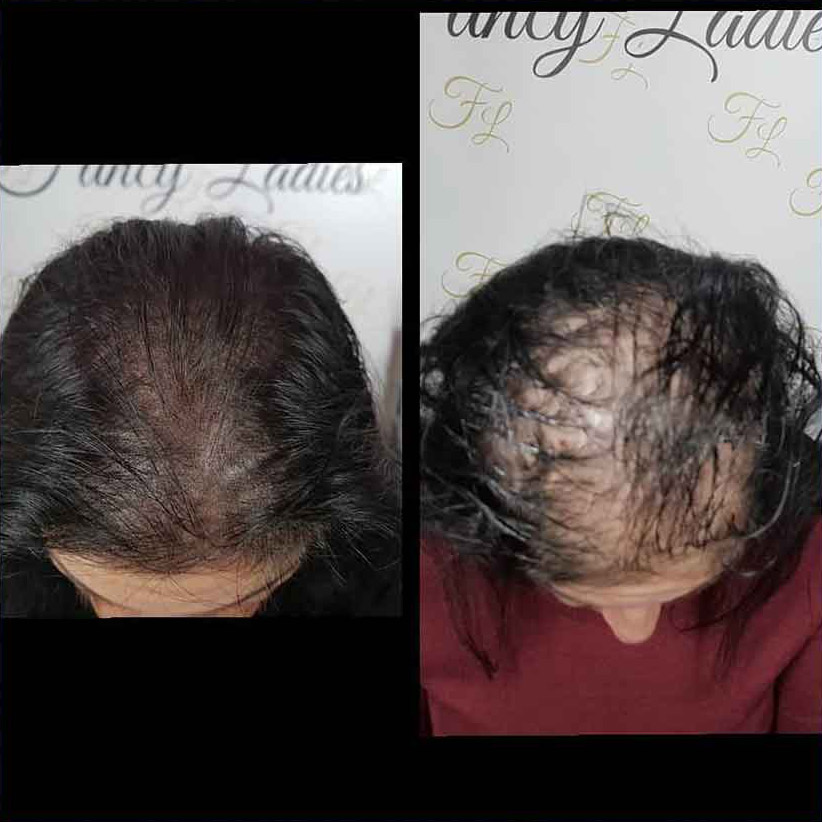 Mikropigmentacija Vlasista10 1