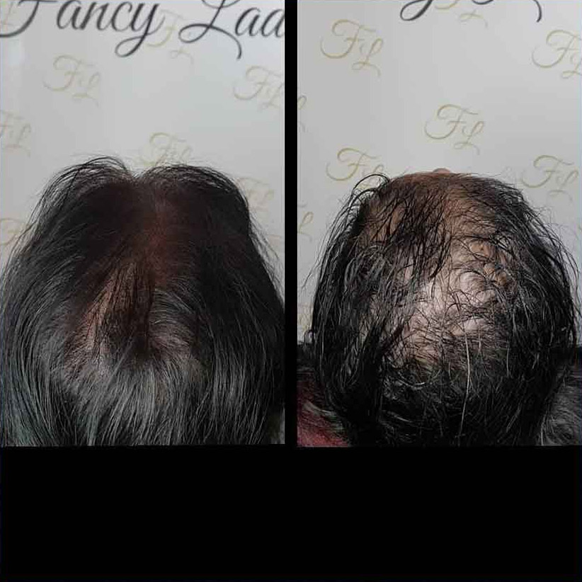 Mikropigmentacija Vlasista11 1