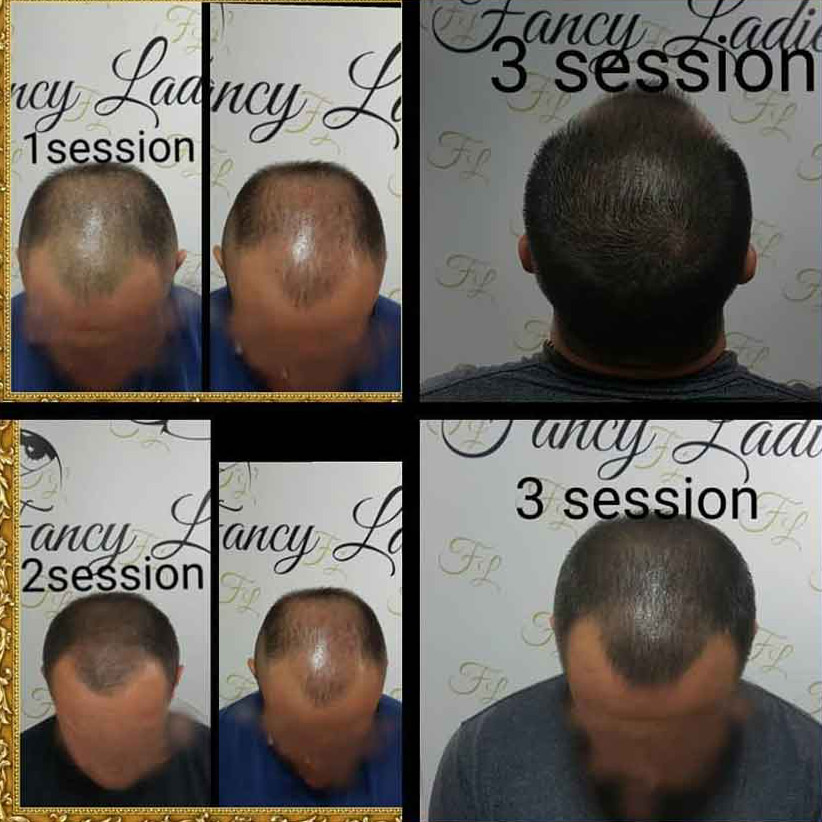 Mikropigmentacija Vlasista4 1