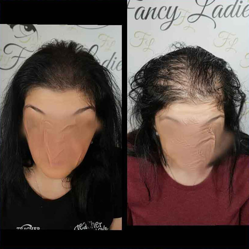 Mikropigmentacija Vlasista9 1